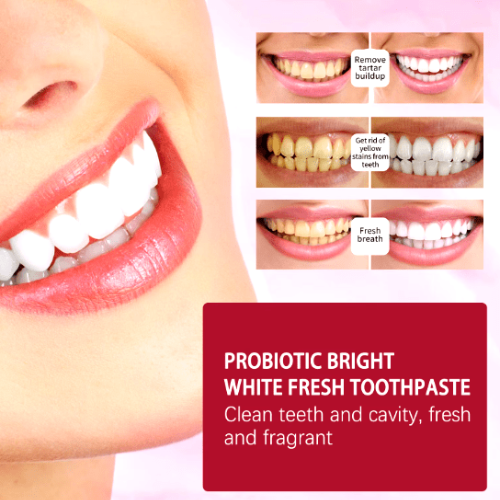 SP-4 Probiotics Toothpaste معجون الأسنان